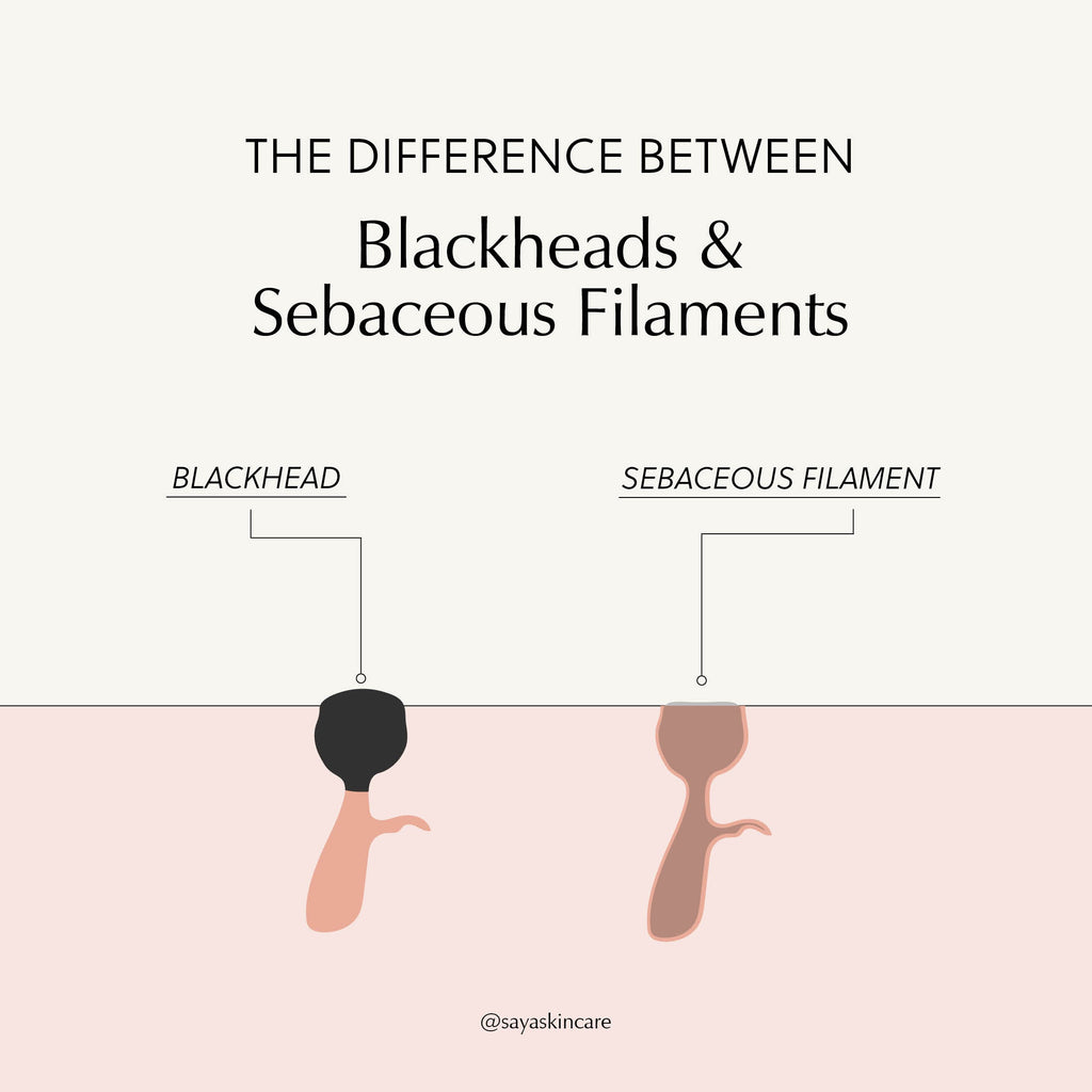 Everything you need to know about Sebaceous Filaments