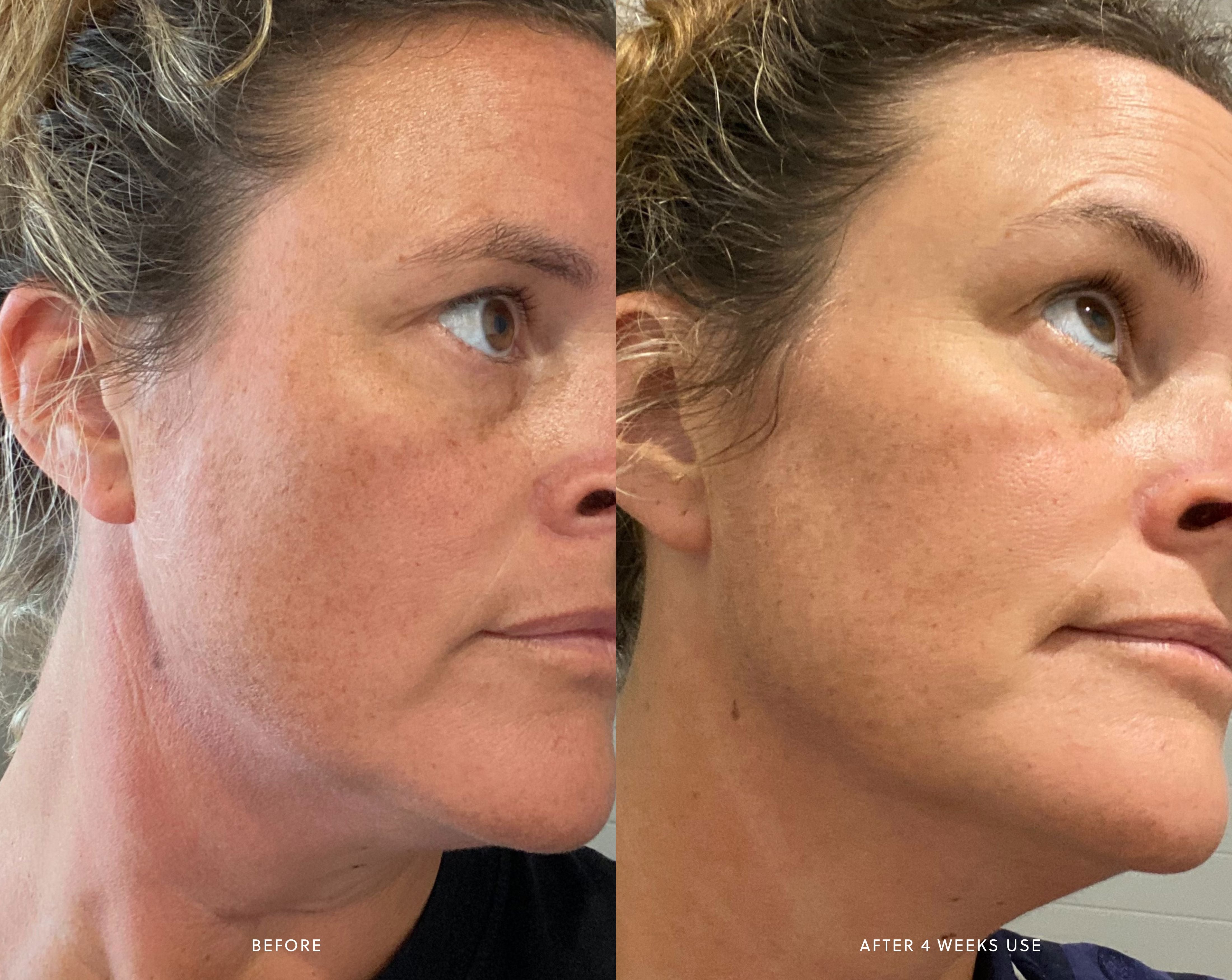 AHA Micro Exfoliator Saya®