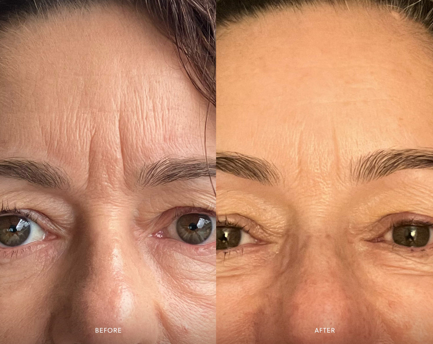 Renew Serum | Bakuchiol Serum Saya