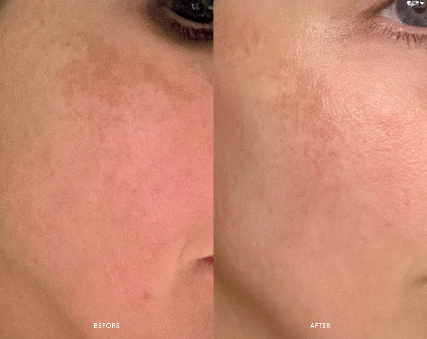 Renew Serum | Bakuchiol Serum Saya