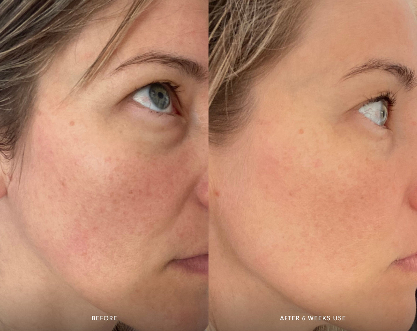 Brightening Peel Exfoliator Saya