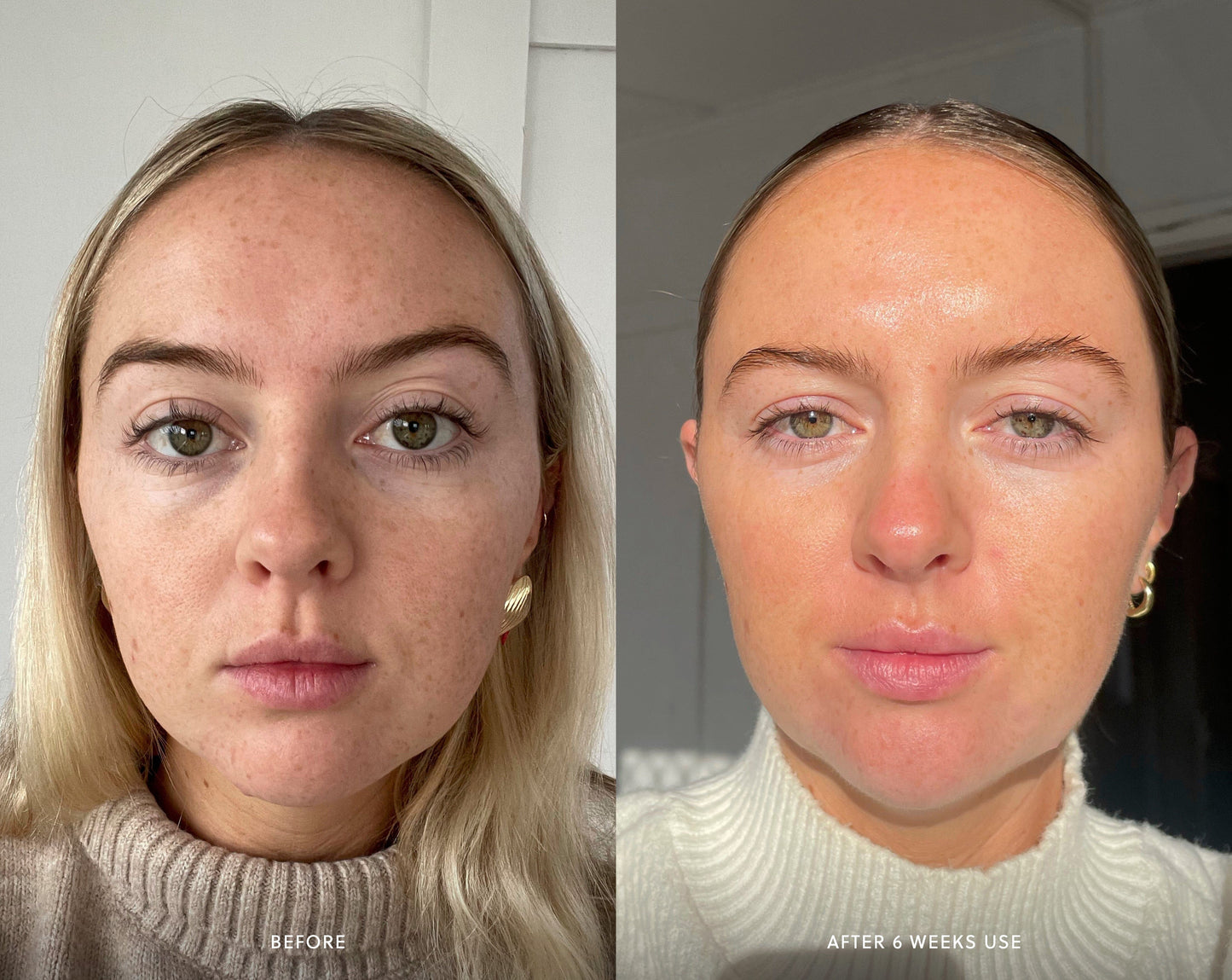 Brightening Peel Exfoliator Saya