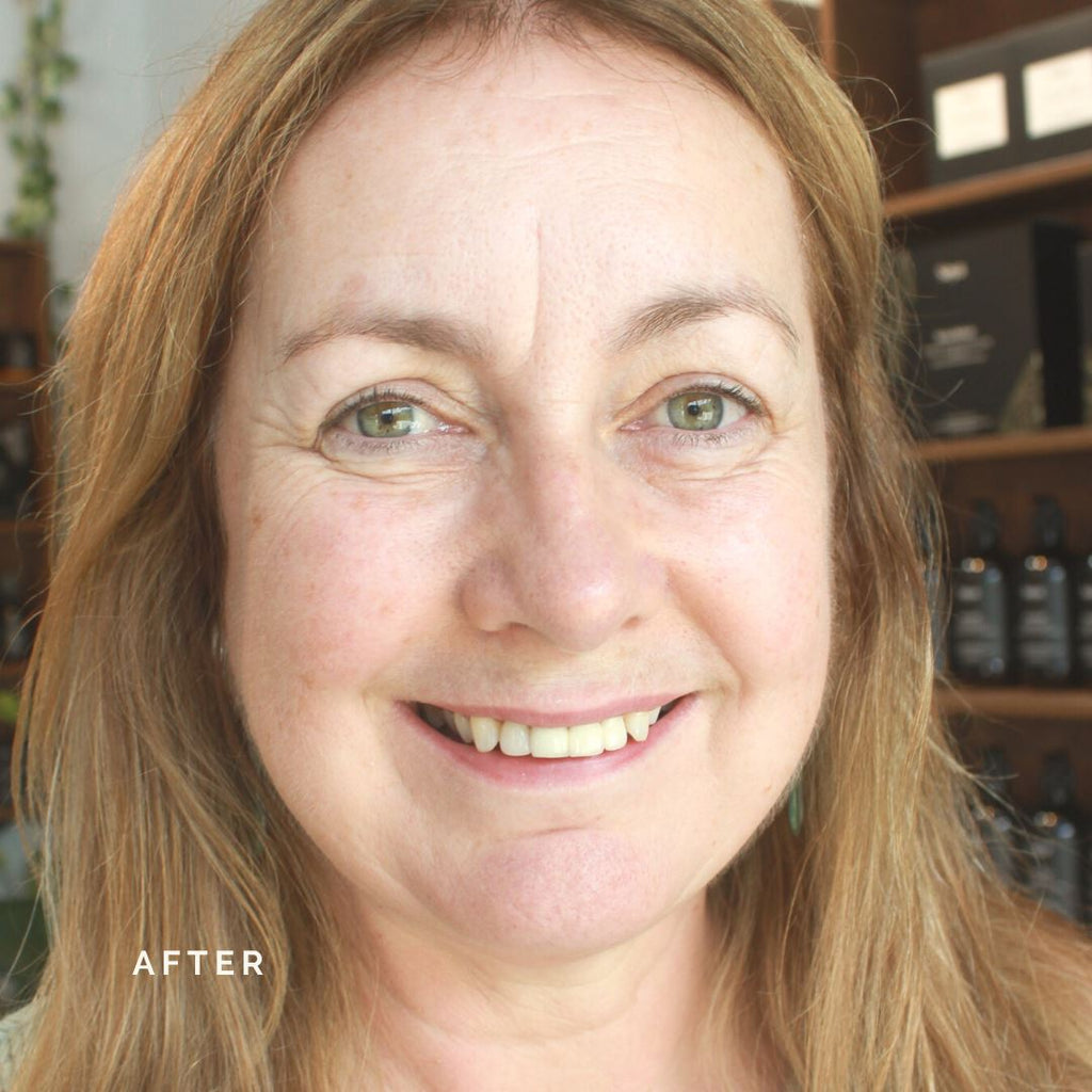 Renew Serum: Before and After - Heather