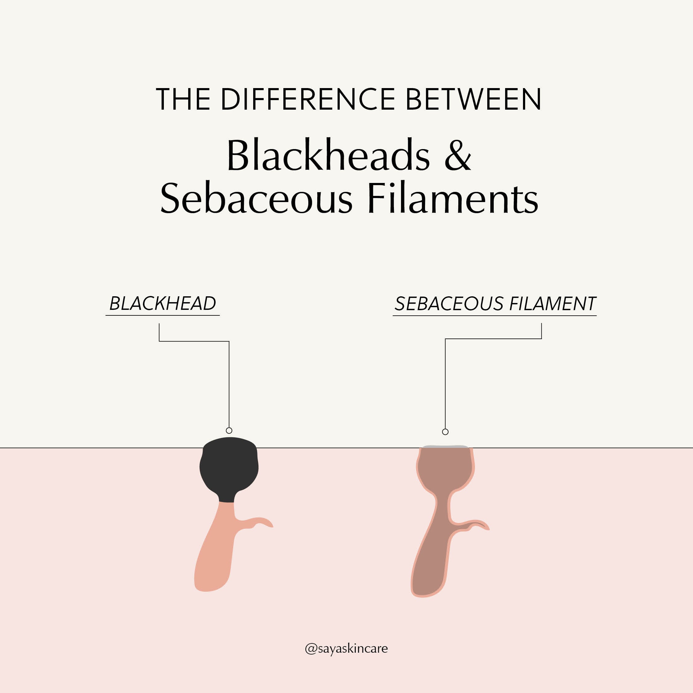 Everything you need to know about Sebaceous Filaments