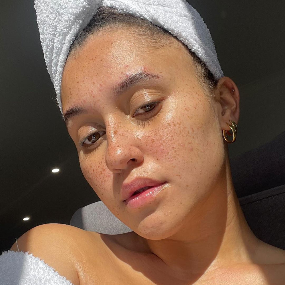 Dealing with Hormonal Breakouts?