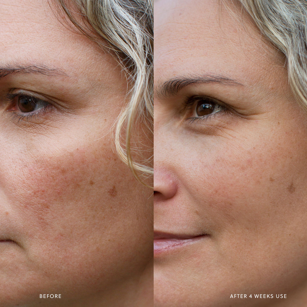 
                      
                        AHA Micro Exfoliator Saya® 
                      
                    