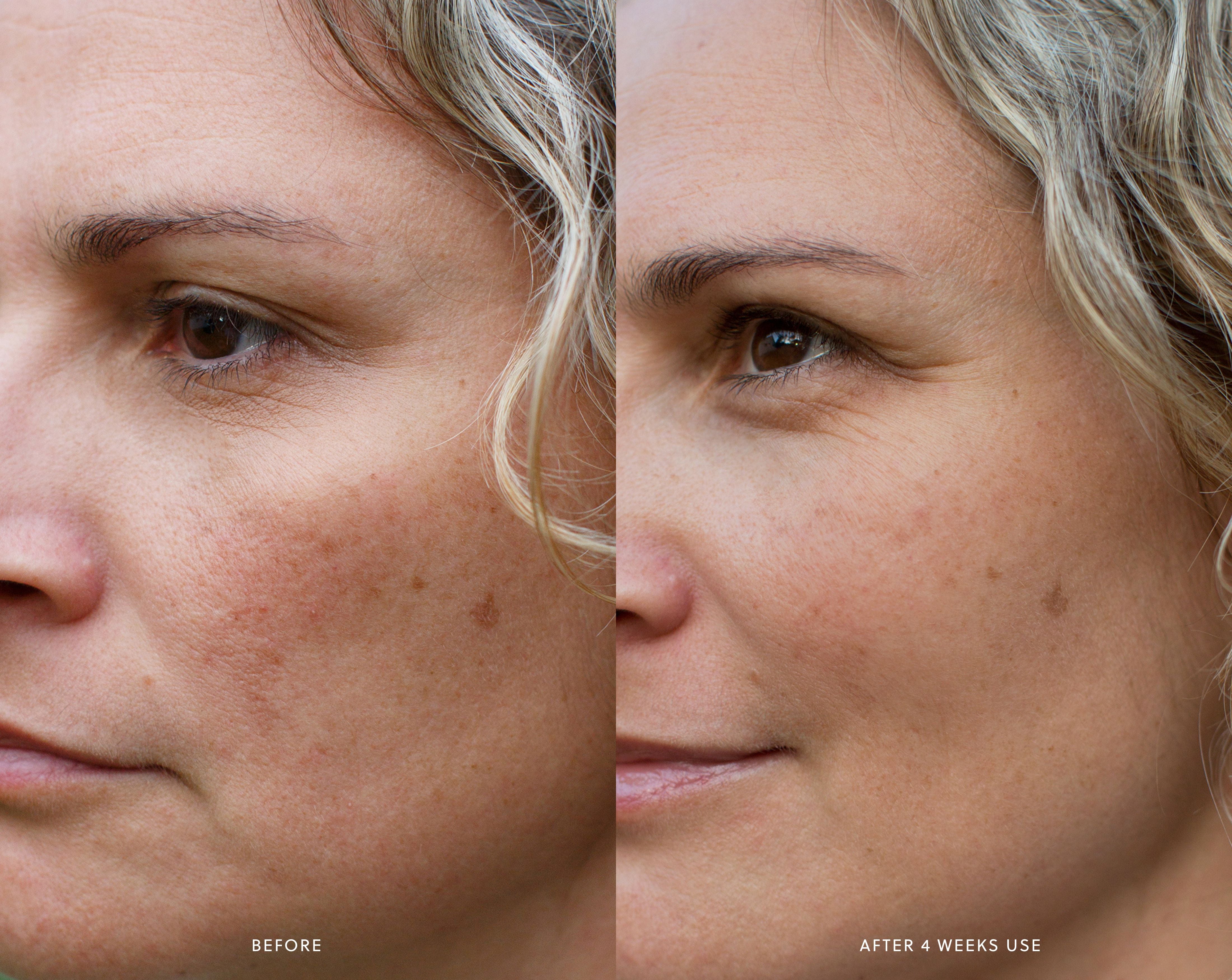 AHA Micro Exfoliator Saya® 