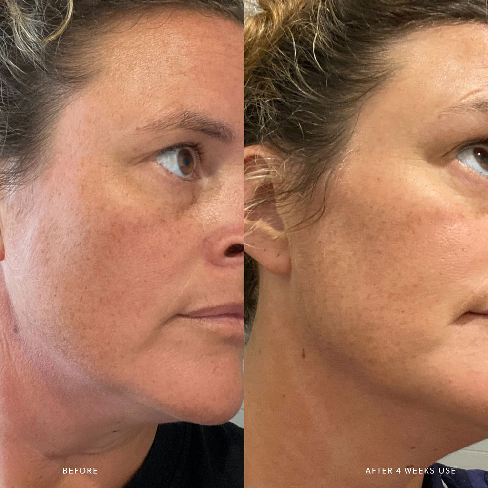 
                      
                        AHA Micro Exfoliator Saya® 
                      
                    