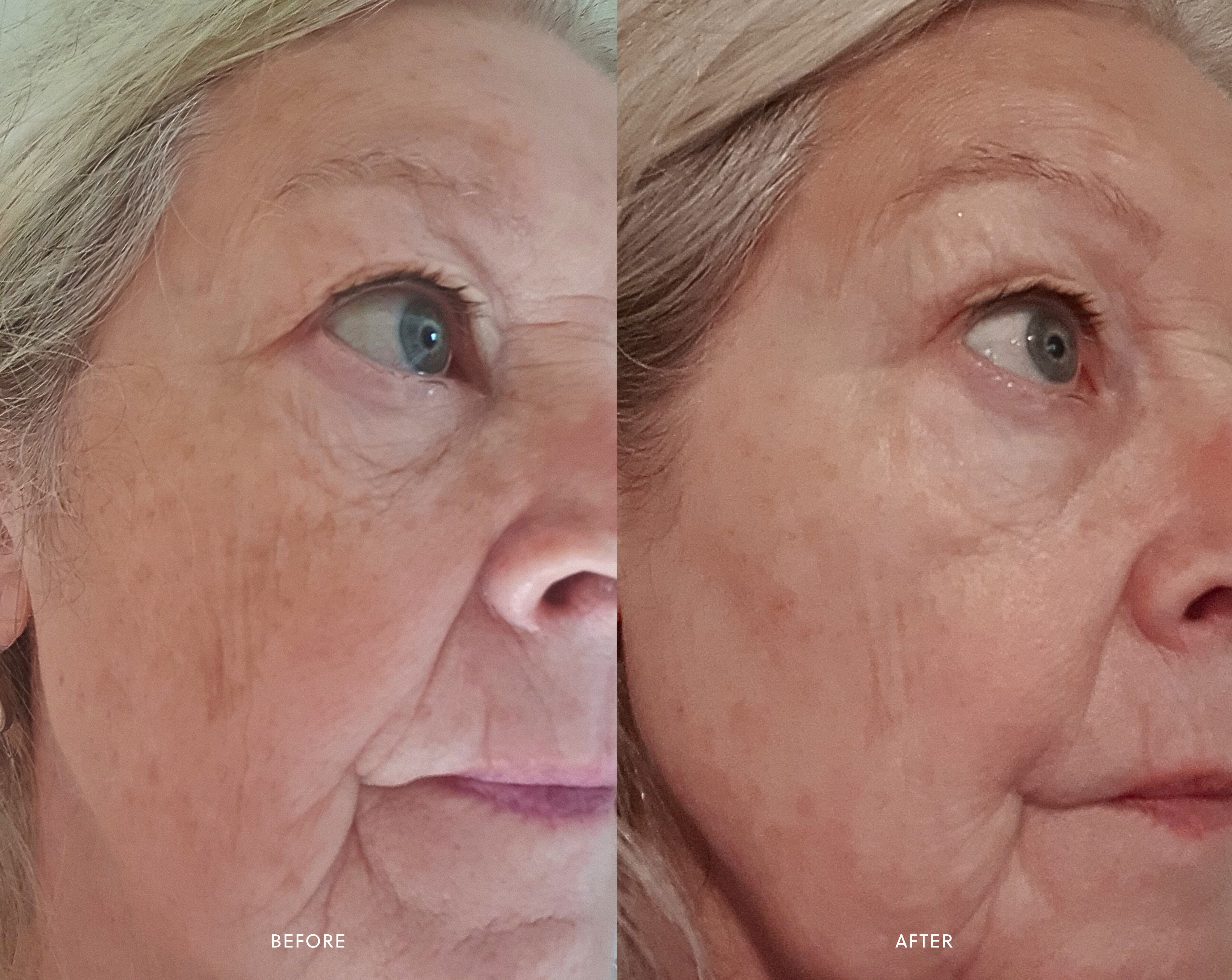 Renew Serum | Bakuchiol Serum Saya 