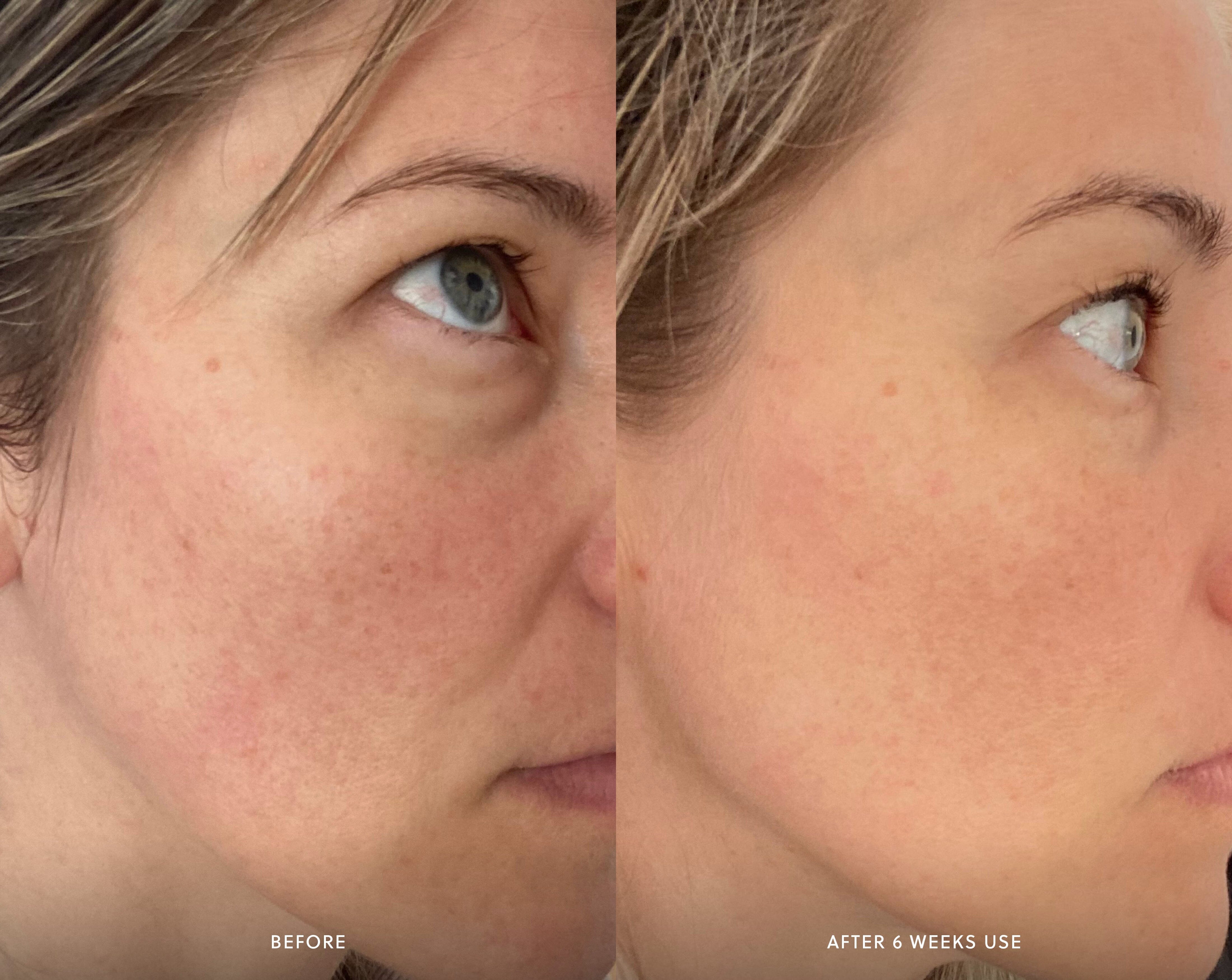 Brightening Peel Exfoliator Saya 